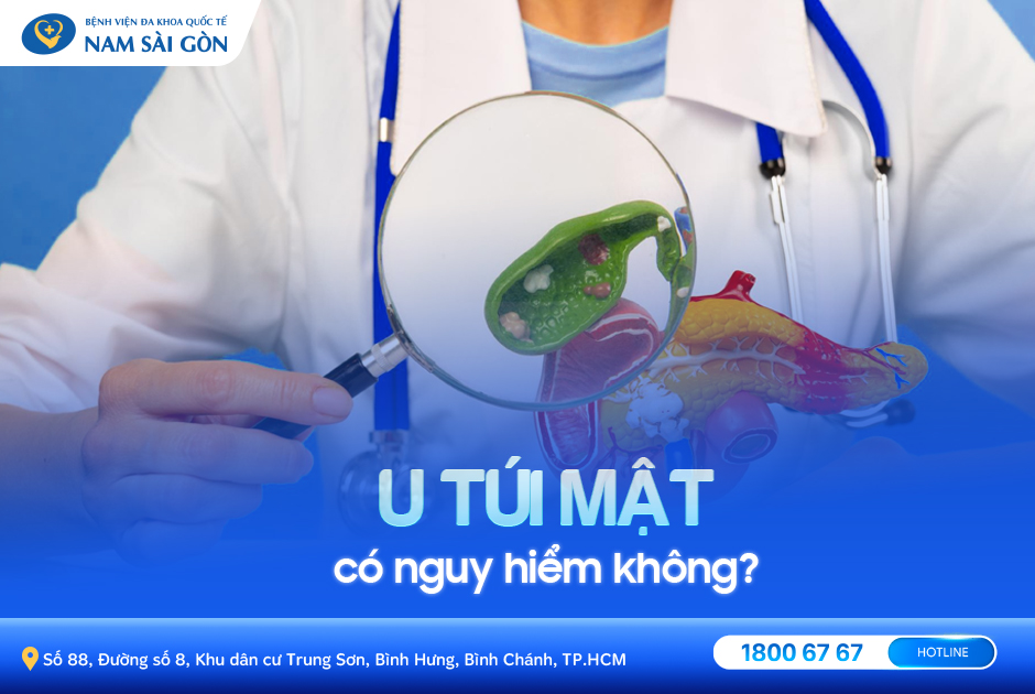 U túi mật - Nguyên nhân, triệu chứng và cách điều trị