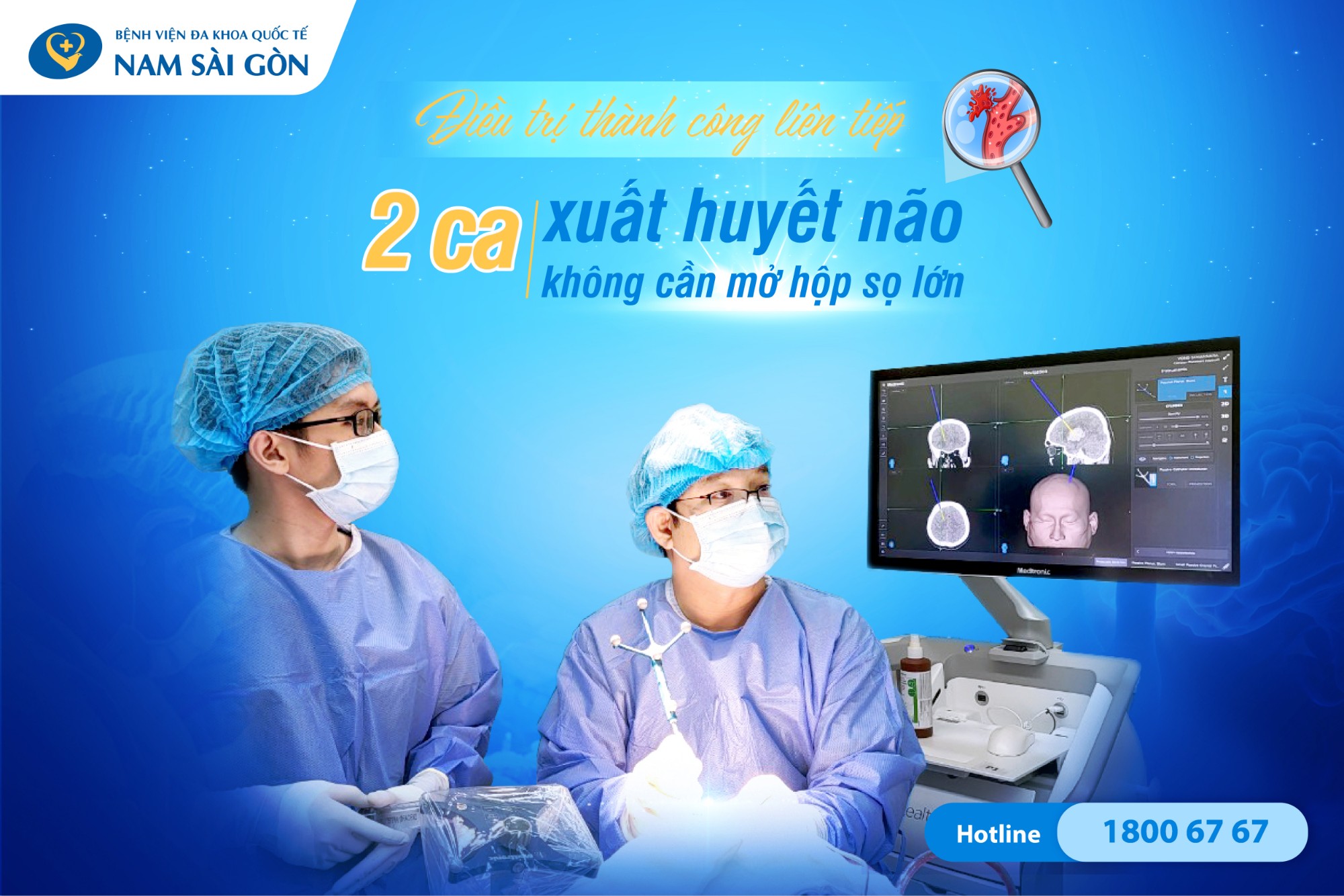 Điều Trị Thành Công Liên Tiếp Hai Trường Hợp Xuất Huyết Não Không Cần Mở Hộp Sọ Lớn 