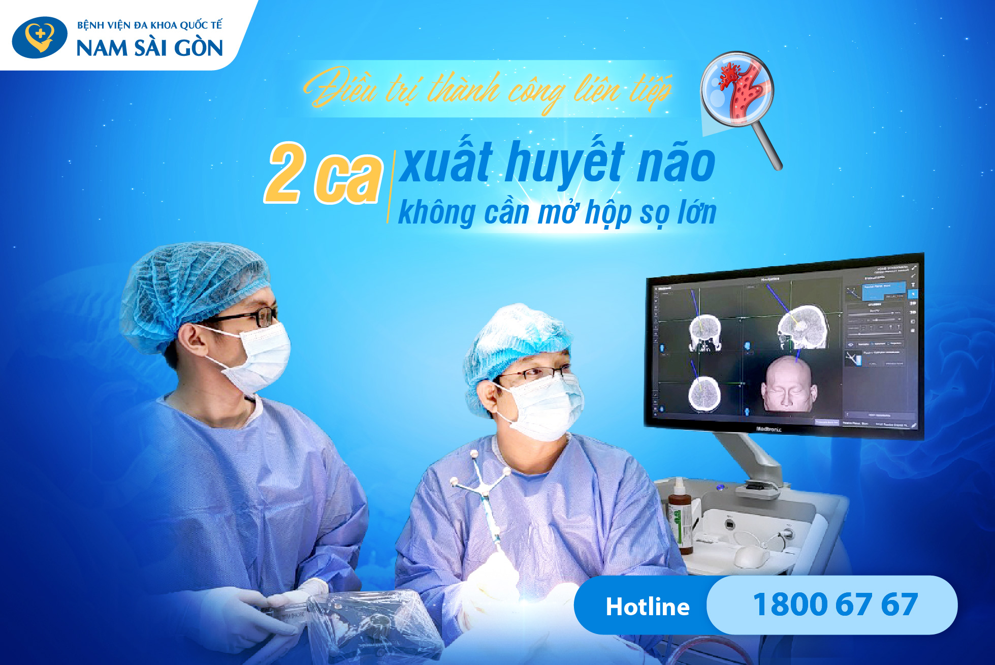 ĐIỀU TRỊ THÀNH CÔNG LIÊN TIẾP CHO 2 TRƯỜNG HỢP XUẤT HUYẾT NÃO KHÔNG CẦN MỞ HỘP SỌ LỚN