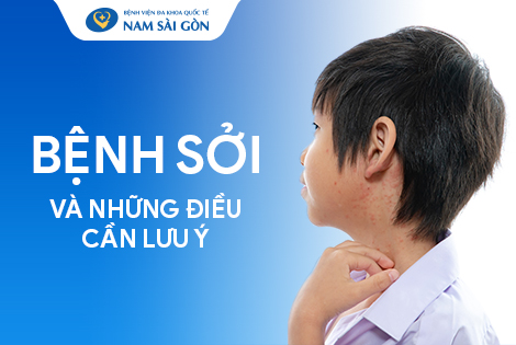 Bệnh sởi - Nguyên nhân, triệu chứng, chẩn đoán và cách điều trị