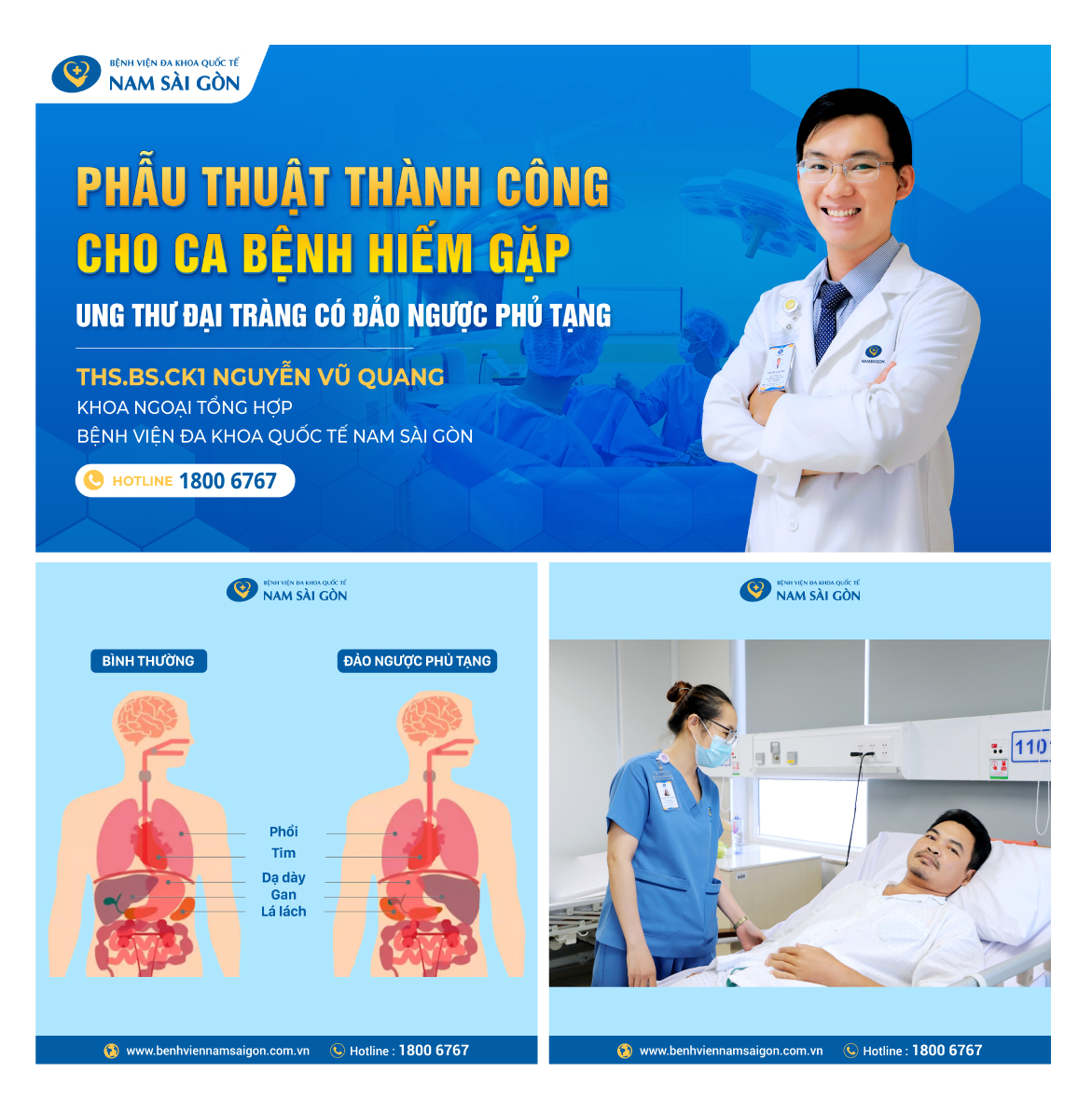 PHẪU THUẬT THÀNH CÔNG CHO CA BỆNH HIẾM GẶP: UNG THƯ ĐẠI TRÀNG CÓ ĐẢO NGƯỢC PHỦ TẠNG.