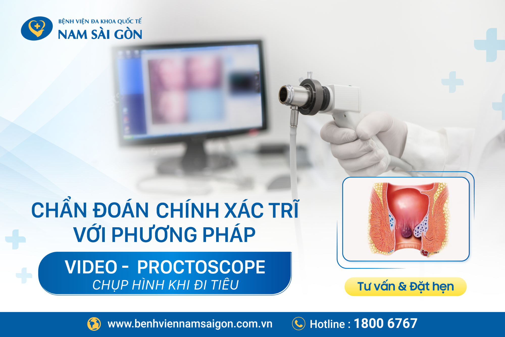 KỸ THUẬT MỚI GIÚP CHẨN ĐOÁN CHÍNH XÁC CẤP ĐỘ TRĨ VÀ SA TRỰC TRÀNG