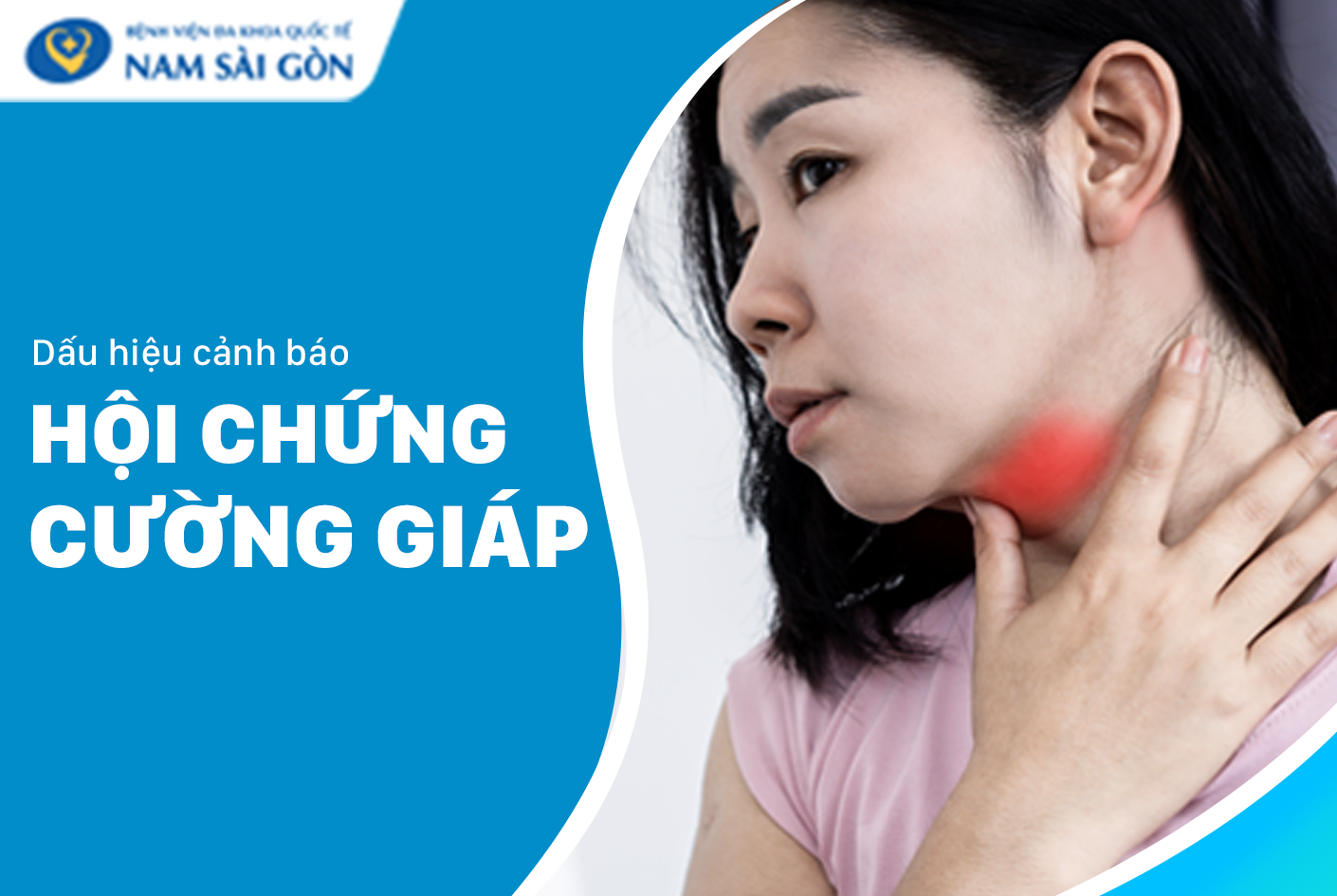 Cường giáp: Dấu hiệu, nguyên nhân, điều trị và cách phòng ngừa