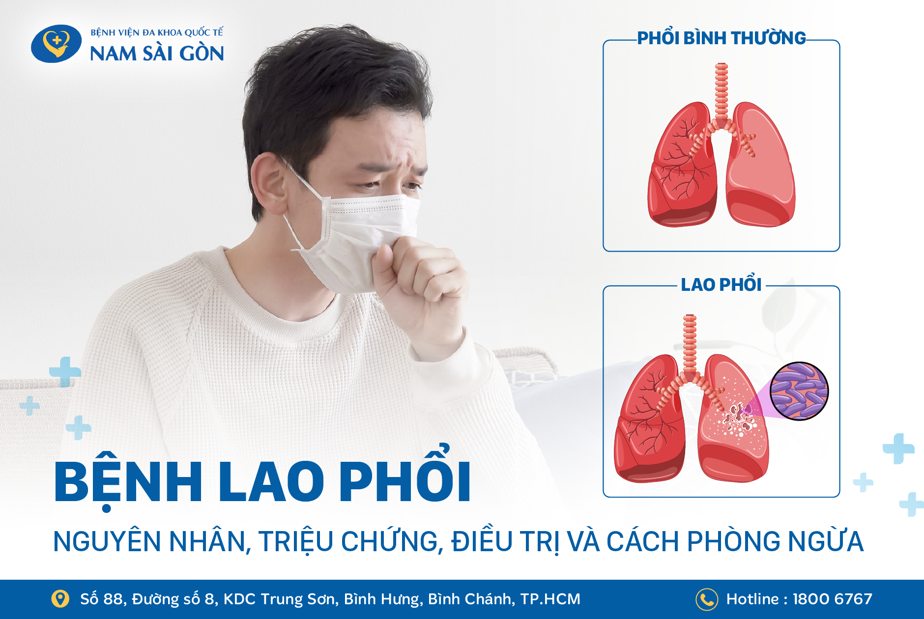 BỆNH LAO PHỔI - NGUYÊN NHÂN, TRIỆU CHỨNG, ĐIỀU TRỊ VÀ CÁCH PHÒNG NGỪA