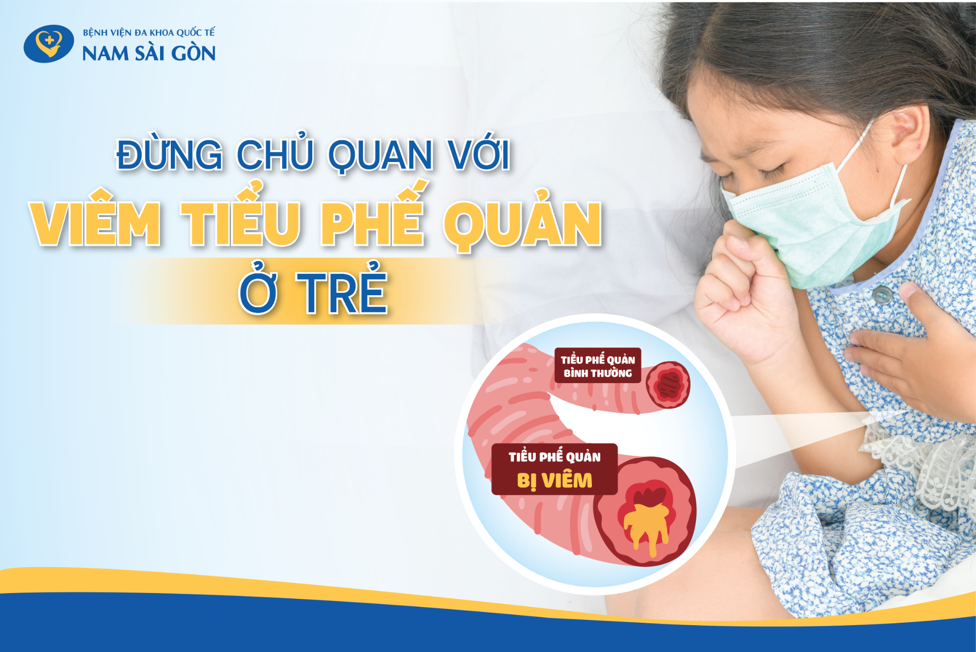 Viêm tiểu phế quản ở trẻ em: Nguyên nhân, dấu hiệu và cách điều trị